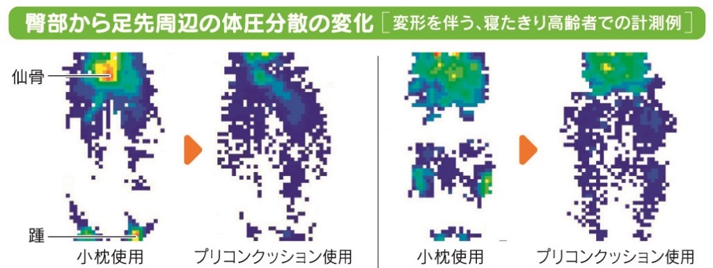 エビデンス-体圧